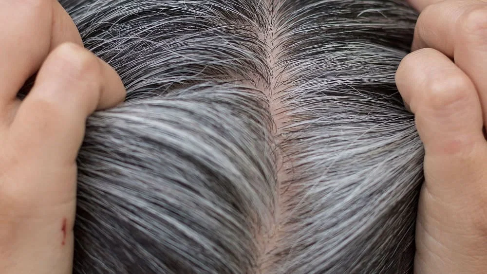 glutathione grey hair premature Graying Treatment | clinic in kharadi Herbal Max L-Glutathione Effervescent