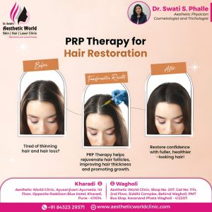hair fall treatment in women