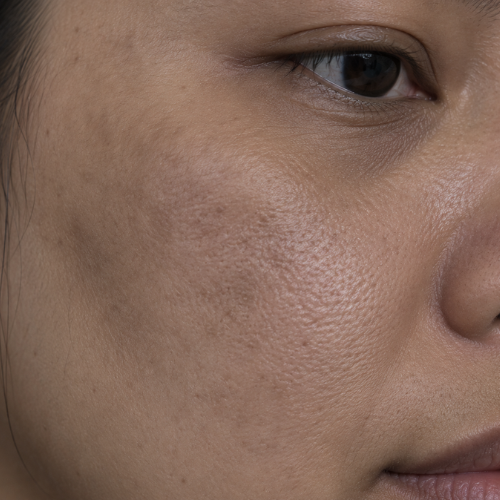 Close-up of dull skin with uneven texture and reduced radiance