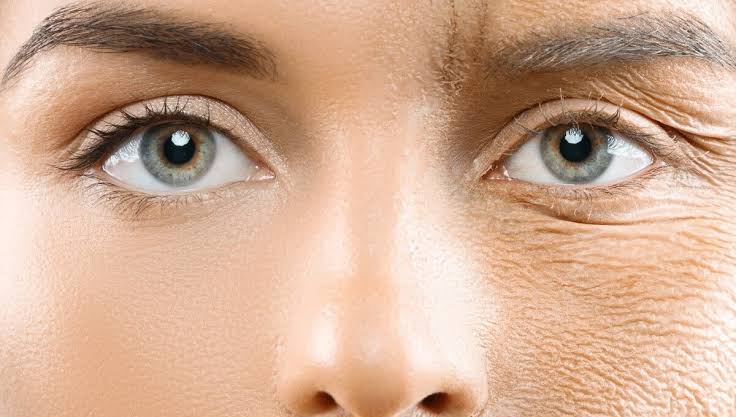 Polynucleotide treatment for crepey under-eye skin