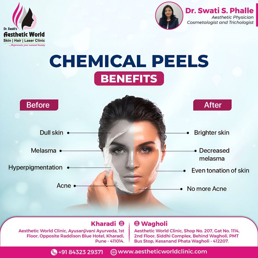 chemical peel cost in pune